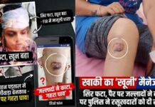 सिर पर पट्टी, टूटे दांत और पैर पर गहरे घाव, फिर भी खाकी ने रसूखदारों को बचाने के लिए खेली क्रॉस कायमी की चाल!