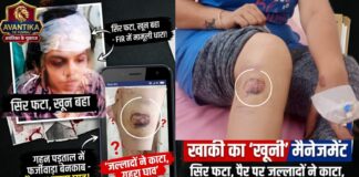 सिर पर पट्टी, टूटे दांत और पैर पर गहरे घाव, फिर भी खाकी ने रसूखदारों को बचाने के लिए खेली क्रॉस कायमी की चाल!