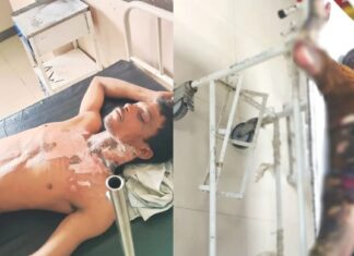 एक युवक गंभीर हालत में झुलसा, तो दूसरी ओर बंद मकान में लकवाग्रस्त बुजुर्ग का बिस्तर बना आग का गोला